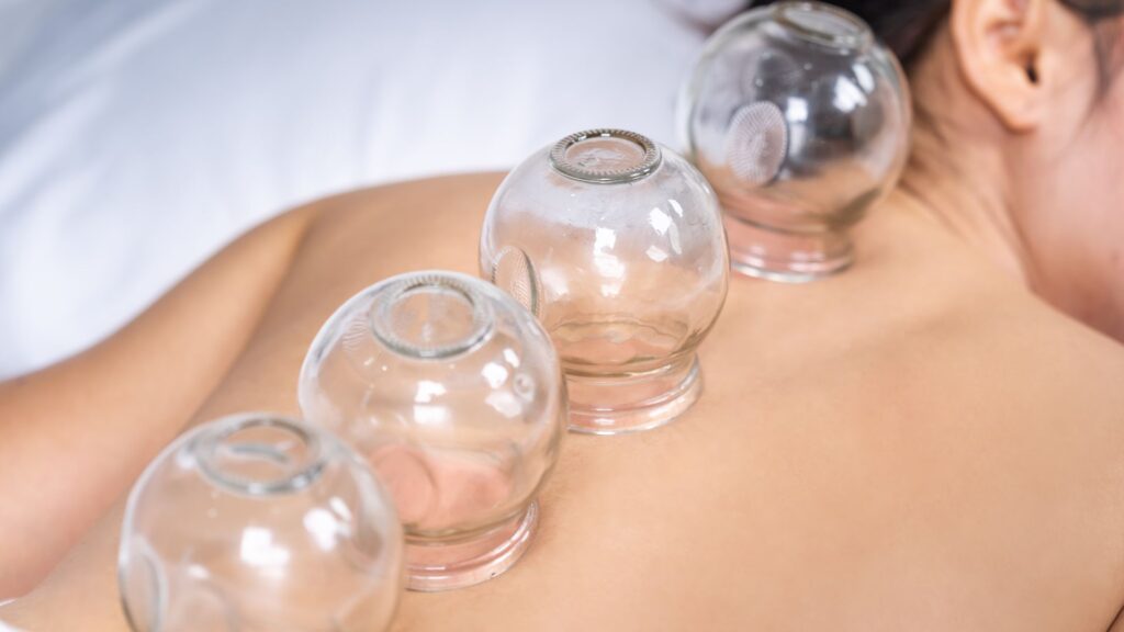 Coppettazione – tecniche complementari della Medicina Cinese